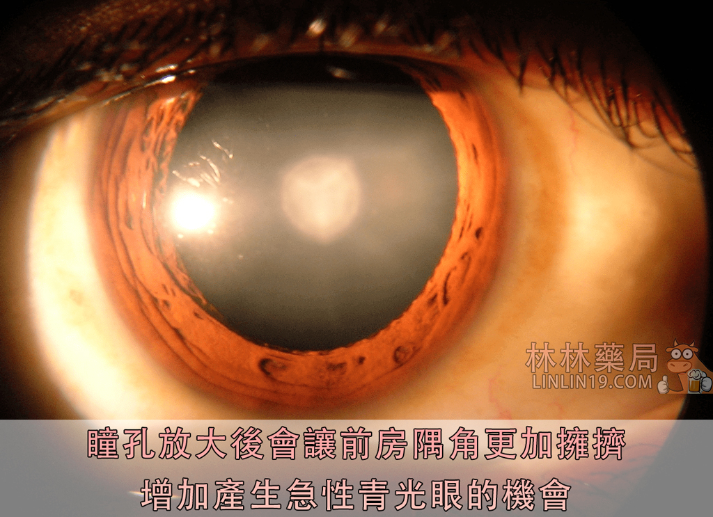 《論威而鋼副作用眼睛的影響：吃威而鋼對眼睛有傷害嗎？》